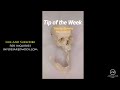 Tip Of The Week Inferior Alveolar Nerve Block