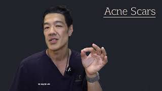 Acne Scar Series | Cutis Dermatology