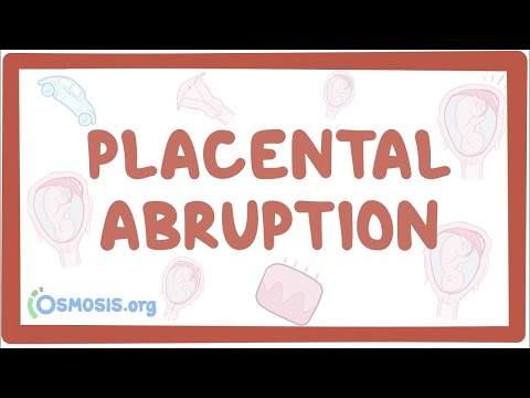 Rheumatic fever heart disease an Osmosis Preview