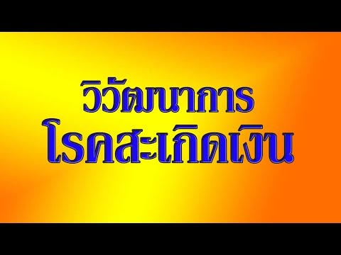 โรคสะเก็ดเงินโรคร่วม โรคสะเก็ดเงินฝ่าเท้าและฝ่ามือรูปภาพ