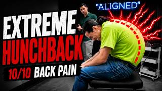 **EXTREME HUNCHBACK** GETS 'FLATTENED!' 😱 | Asmr Chiropractic Neck & Back Pain | Dr Tubio