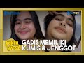 Viral Gadis Miliki Kumis Dan Jenggot Tipis Di Wajah Begini Pengakuannya