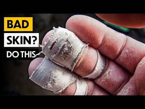 Ultimate Guide to Climbing Skin Care