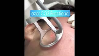 CO2 Fractional Laser Mechanism