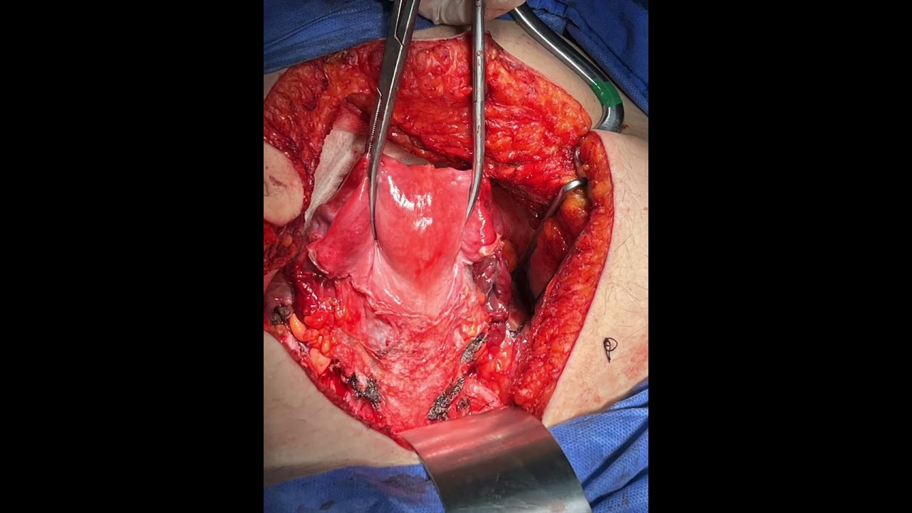 Ángel Millán Juárez-87