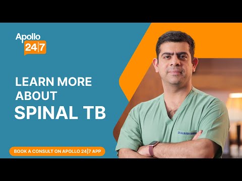 Spinal TB Treatment (In Hindi) | Dr. Saurabh Rawall