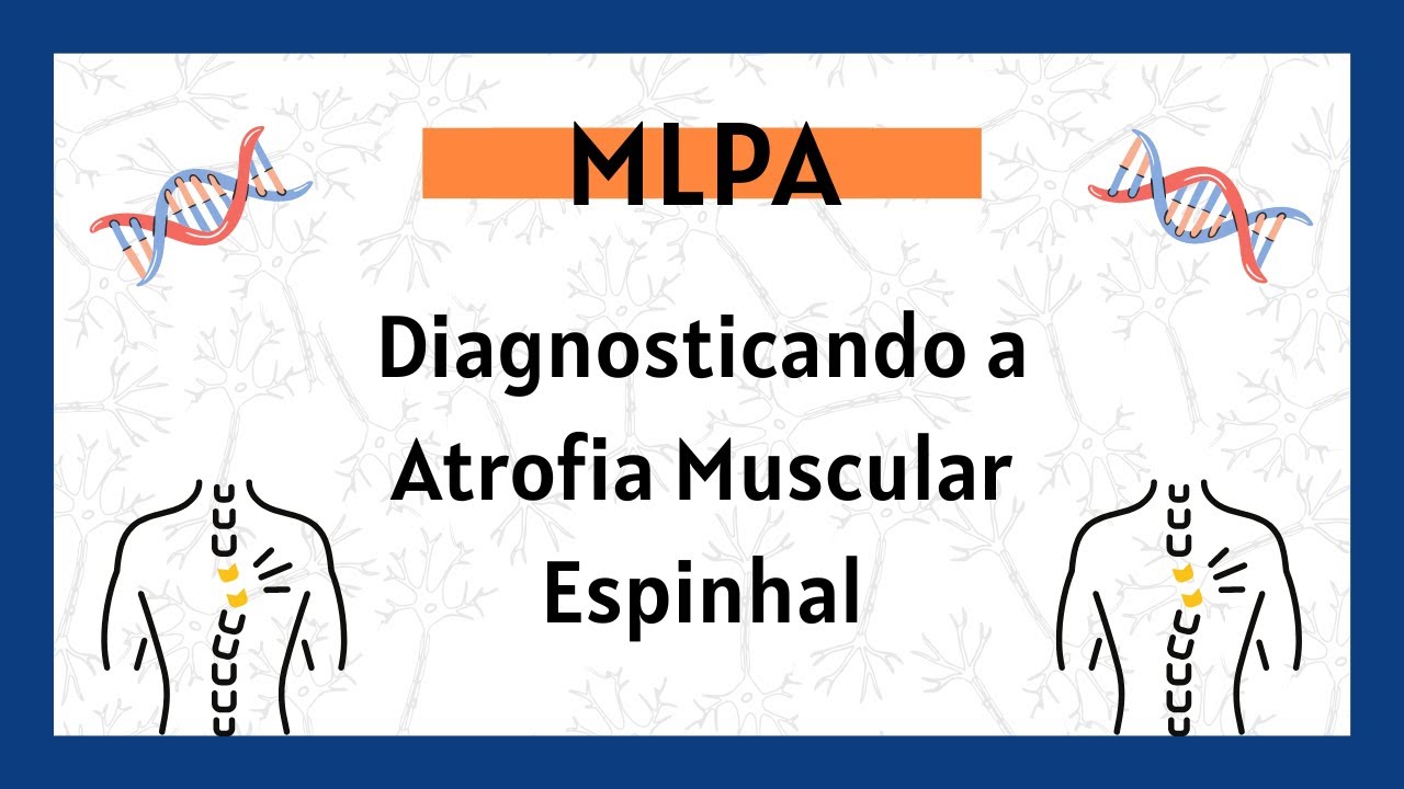 MLPA: uma técnica biotecnológica para o diagnóstico de Atrofia Muscular Espinhal