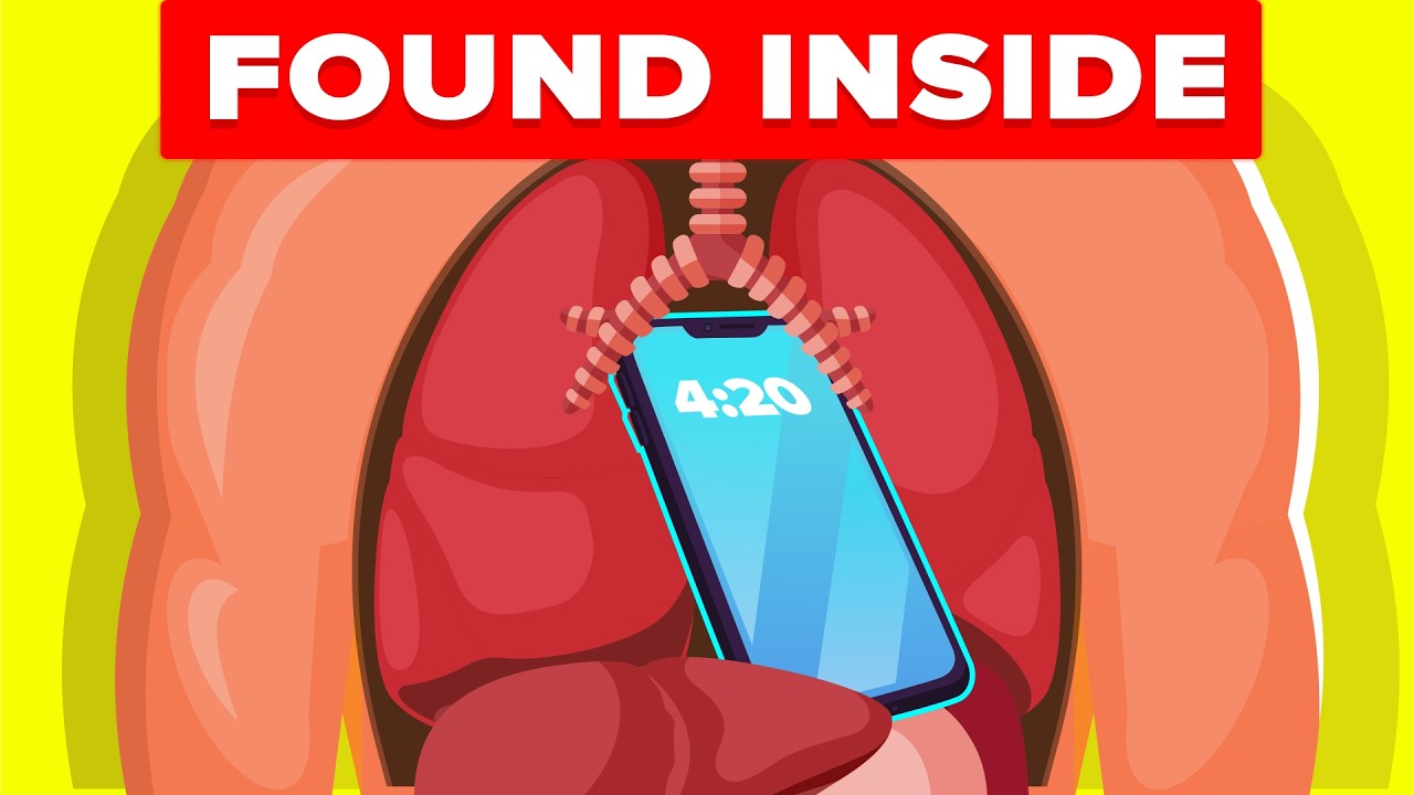 Insane Things Removed From Inside Person's Body and More Medical Nightmares (Compilation)