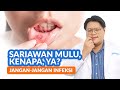 Apa Sih Penyebab Sariawan