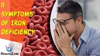 11 Symptoms Of Iron Deficiency You Must Not Ignore