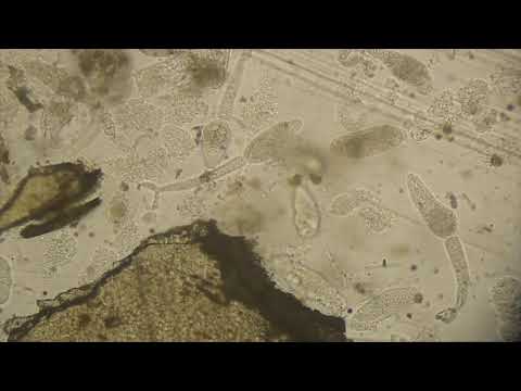 Montage of schistosome cercariae moving through water