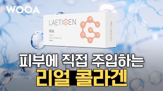 피부 속 콜라겐 직접 충전! 레티젠 시술 완전정복