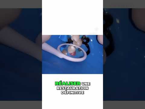 Coiffage pulpaire direct – Endodontie