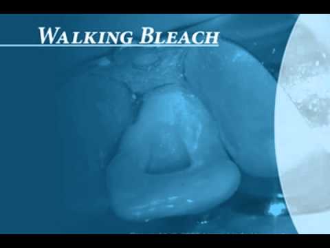 Endodontics Torabinejad 22 0 Walking Bleach Introduction