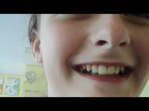 Cl. a v-a ,,A" Din Moldova