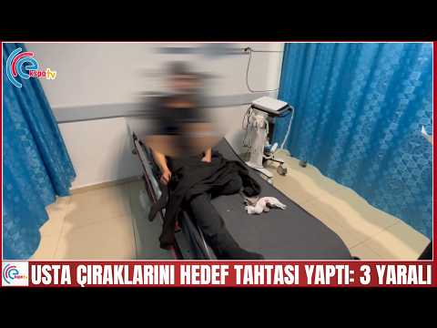 Usta çıraklarını hedef tahtası yaptı 3 yaralı