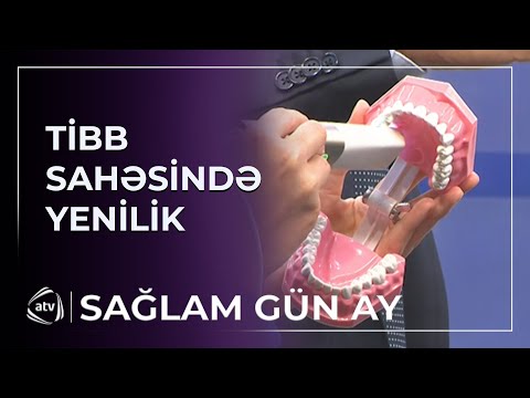 Günlərlə gözləməyə son! - "Saniyələr içərisində hazır olacaq..."