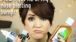 How I got rid of my nose piercing bump quickly!