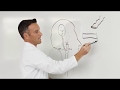 What is Brain Bypass Surgery?