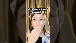 จัดฟันใสเสร็จแล้ว2รอบ6ปี @smileoperationsbkk #erkerkxsmileoperationsbkk #smileoperations #invisalign