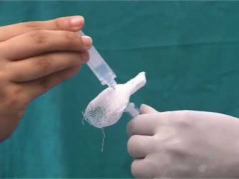 Fibrin Sealant Kit