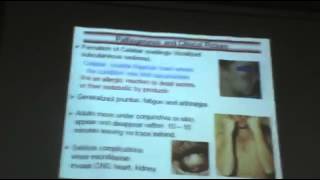 Dr Azza   Parasitology   Helminths   Nematodes 8   Subcutaneous Filaria   YouTube