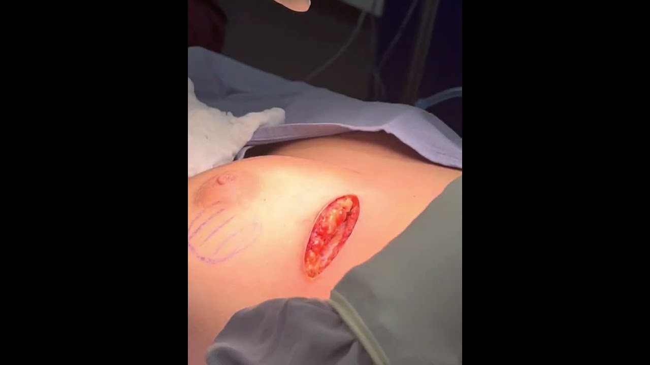 Ángel Millán Juárez-79