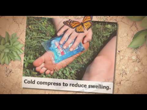 Physio and stress fractures