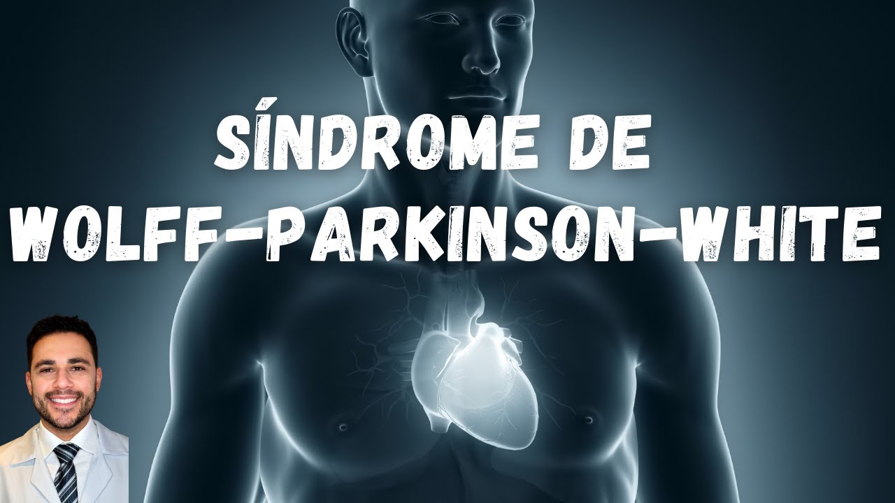 Síndrome de Wolff-Parkinson-White - Cardiologista e Especialista em Arritmias - Dr. Caio Henrique