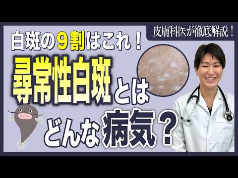 尋常性白斑について医師が解説