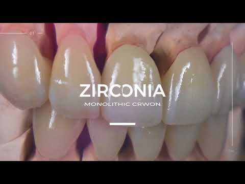 Almost Full Restoration by Full Zirconia  in Digital Dentistry