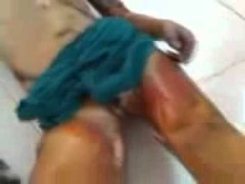 جثمان الطفل مصطفى جركس في دير الزور في محافظة دير الزور