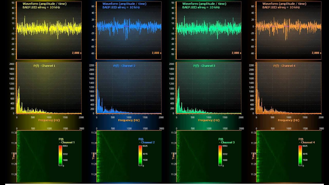 LightningChart Ultimate biosignal data visualization with spectrum views