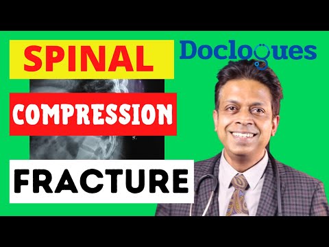 What Is Spinal Compression Fracture?