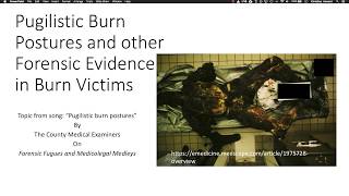 Pugilistic Burn Postures