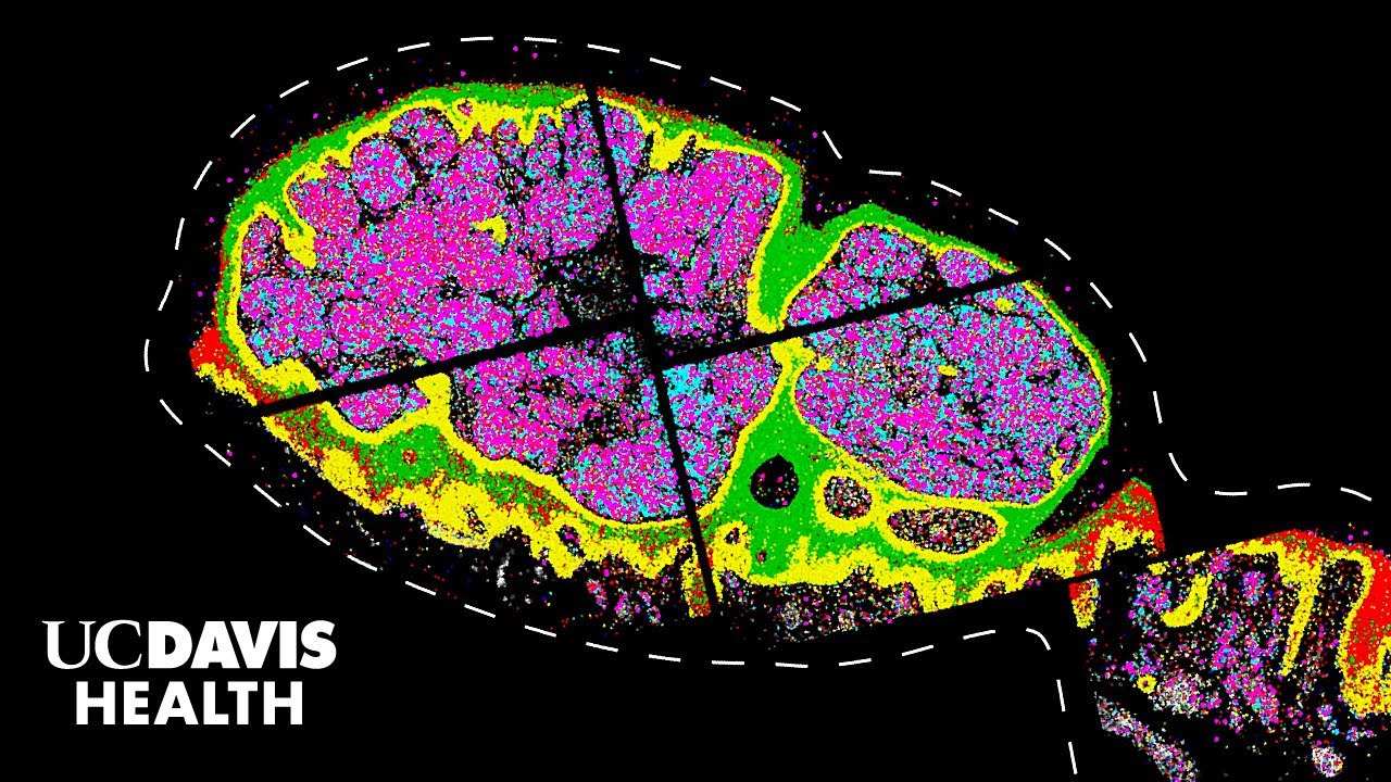Thumbnail preview of New Genetic Clues About Melanoma Revealed Through Powerful Imaging - Driving Discovery