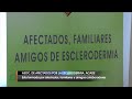 Asociación de Esclerodermia