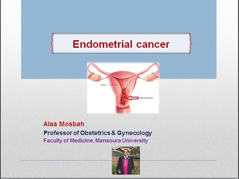 Endometrial cancer