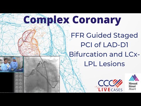 FFR Guided Staged PCI of LAD-D1 Bifurcation and LCx-LPL Lesions - August 18, 2015 Webcast