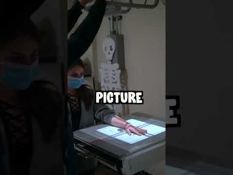 I BROKE MY WRIST #shorts