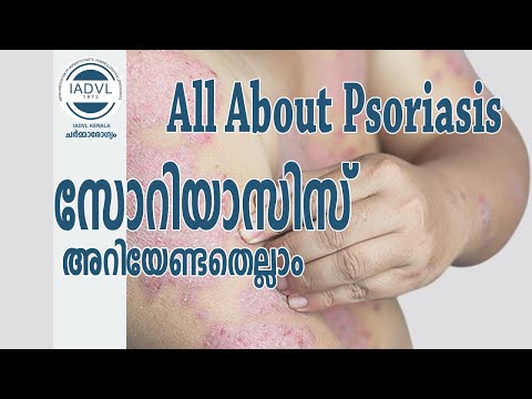 All About Psoriasis