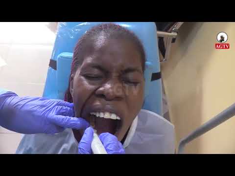 NGO TAKES FREE DENTAL CARE TO KARU LOCAL GOVERNMENT OF NASARAWA STATE