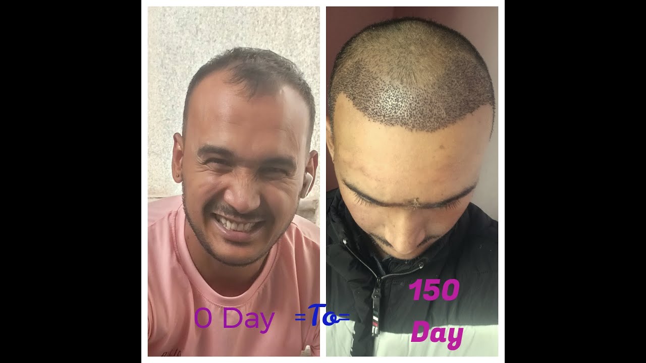 How can I get an invoice for my purchase?