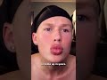 The Fake IShowSpeed Whiteboyem
