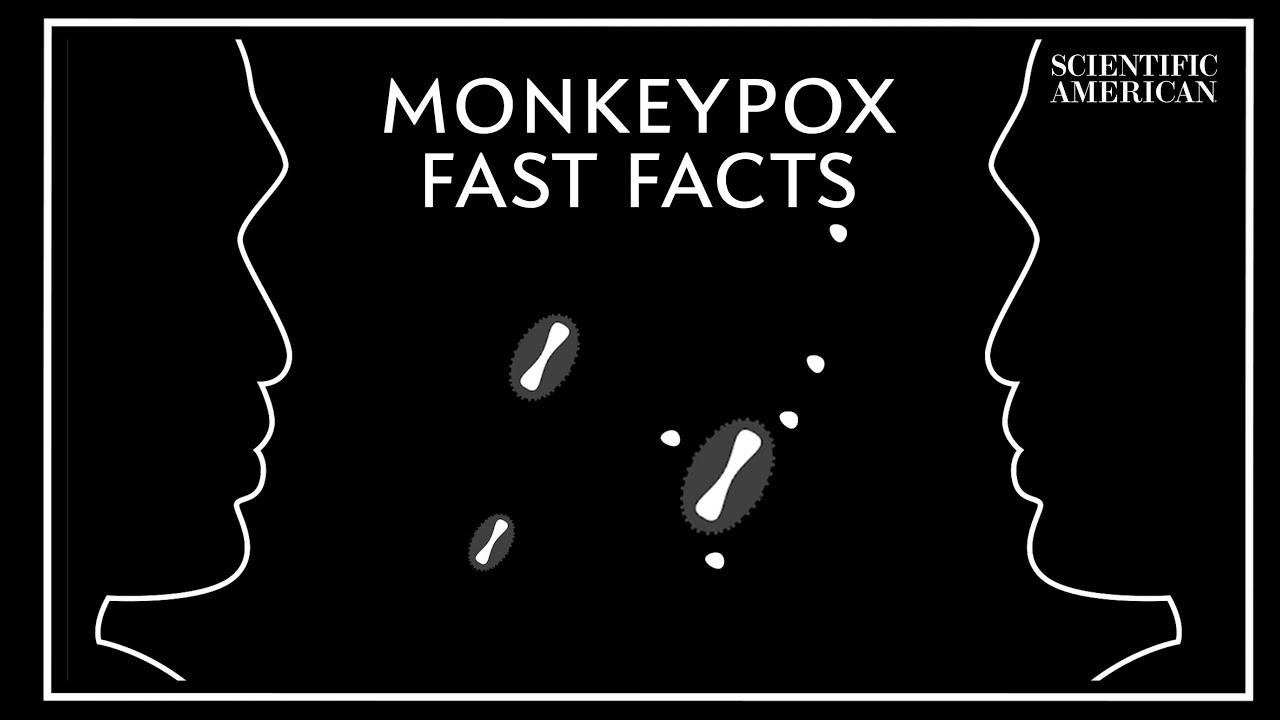 5 Things to Know about Monkeypox