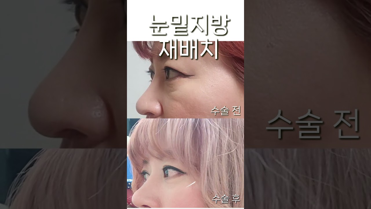더라인 쇼츠 영상