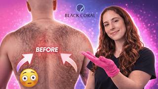 Extreme Back Wax Transformation