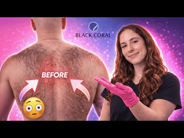 Extreme Back Wax Transformation
