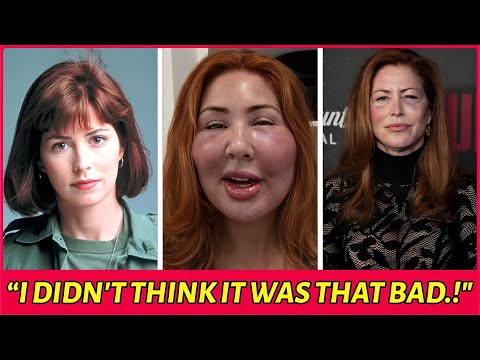 22 Hollywood Celebrities Who Ruined Their Careers With Plastic Surgery