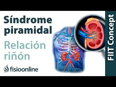 Síndrome del músculo piramidal izquierdo y su relación con el riñón